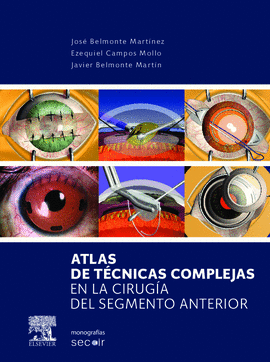 ATLAS DE TECNICAS COMPLEJAS EN LA CIRUGIA DEL SEGMENTO ANTERIOR