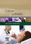 CÁNCER DE TIROIDES