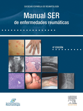 SER, MANUAL SER DE REUMATOLOGÍA © 2014