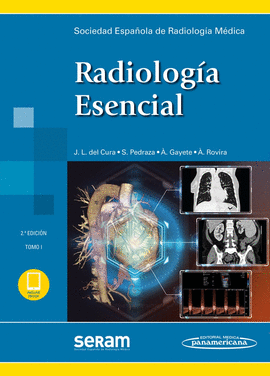 SERAM:RADIOLOG?A ESENCIAL  2ED, 2T+E