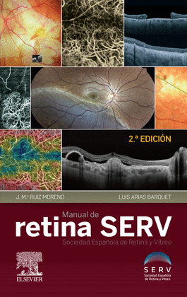 MANUAL DE RETINA SERV (2ª ED.)