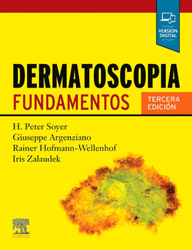 DERMATOSCOPIA
