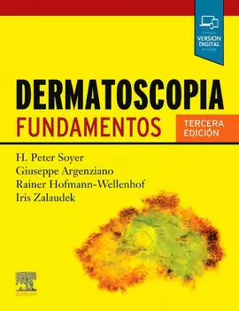 DERMATOSCOPIA