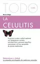TODO SOBRE LA CELULITIS