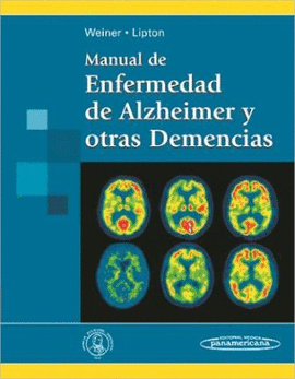 MANUAL DE ENFERMEDAD DE ALZHEIMER Y OTRAS DEMENCIAS