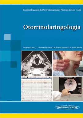 OTORRINOLARINGOLOGÍA