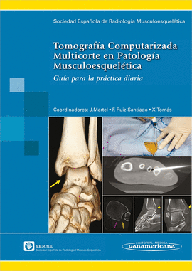 TOMOGRAFÍA COMPUTARIZADA MULTICORTE EN PATOLOGÍA MUSCULOESQUELÉTICA. GUÍA PARA LA PRÁCTICA DIARIA