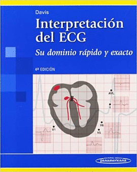 INTERPRETACIÓN DEL ECG