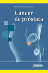 CANCER DE PROSTATA