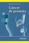 CANCER DE PROSTATA