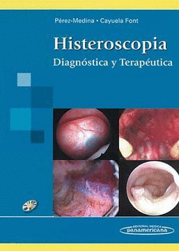 HISTEROSCOPIA