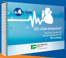 ECG: ¿CÓMO INTERPRETARLO? SEGUNDA EDICIÓN