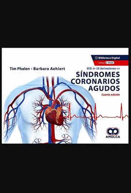 ECG DE 12 DERIVACIONES EN SINDROMES CORONARIOS AGUDOS 4A. ED