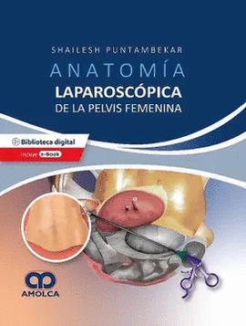 ANATOMIA LAPAROSCOPICA DE LA PELVIS FEMENINA. PRINCIPIOS