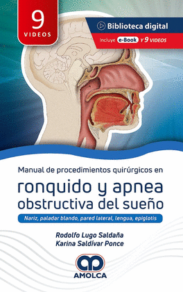 MANUAL DE PROCEDIMIENTO QUIRÚRGICOS EN RONQUIDO