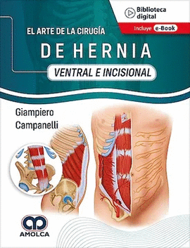 EL ARTE DE LA CIRUGIA DE HERNIA VENTRAL E INCISIONAL