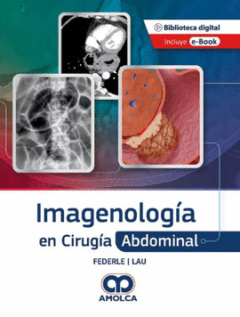 IMAGENOLOGÍA EN CIRUGÍA ABDOMINAL