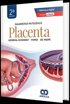 DIAGNOSTICO PATOLOGICO: PLACENTA