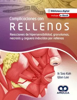 COMPLICACIONES CON RELLENOS. REACCIONES DE HIPERSENSIBILIDAD