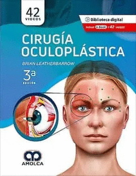 CIRUGIA OCULOPLASTICA