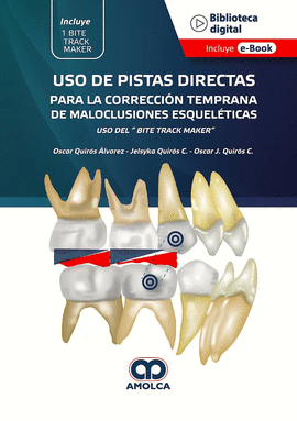 USO DE PISTAS DIRECTAS PARA LA CORRECCIÓN TEMPRANA