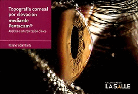 TOPOGRAFÍA CORNEAL POR ELEVACIÓN MEDIANTE PENTACAM