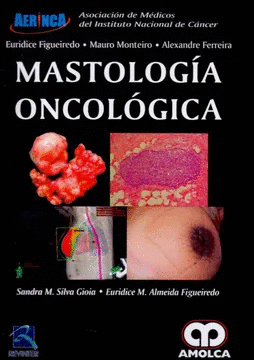 MASTOLOGIA ONCOLOGICA