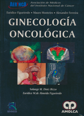 GINECOLOGÍA ONCOLOGÍA