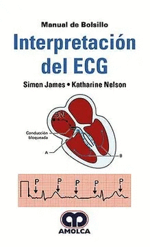 MANUAL DE BOLSILLO  INTERPRETACIÓN DEL ECG