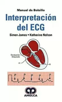 MANUAL DE BOLSILLO  INTERPRETACIÓN DEL ECG