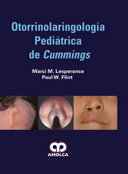 OTORRINOLARINGOLOGÍA PEDIÁTRICA DE CUMMINGS
