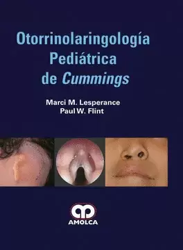 OTORRINOLARINGOLOGÍA PEDIÁTRICA DE CUMMINGS