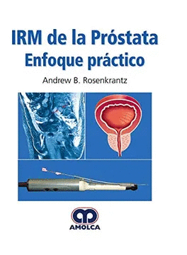 IRM DE LA PRÓSTATA ENFOQUE PRÁCTICO