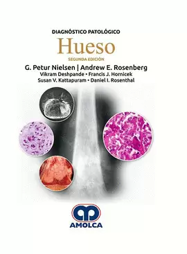 DIAGNÓSTICO PATOLÓGICO: HUESO