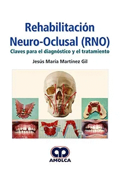 REHABILITACION NEURO OCLUSAL (RNO)