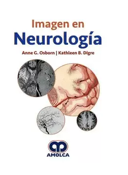 IMAGEN EN NEUROLOGÍA
