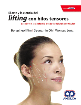 EL ARTE Y LA CIENCIA DEL LIFTING CON HILOS TENSORES