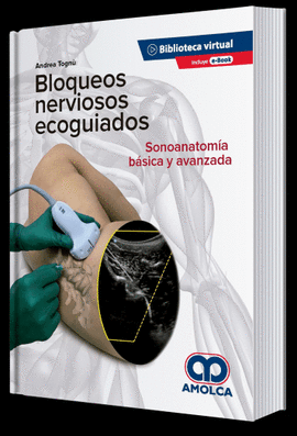 BLOQUEOS NERVIOSOSO ECOGUIADOS. SONOANATOMÍA BÁSICA Y AVANZADA