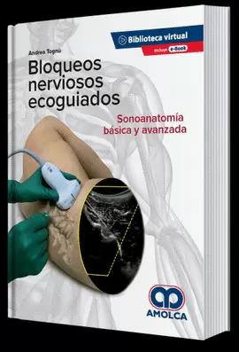 BLOQUEOS NERVIOSOSO ECOGUIADOS. SONOANATOMÍA BÁSICA Y AVANZADA
