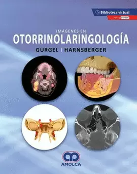 IMÁGENES EN OTORRINOLARINGOLOGÍA