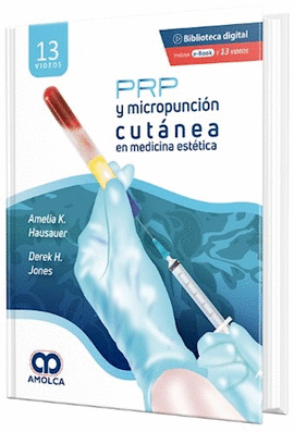 PRP Y MICROPUNCION CUTANEA EN MEDICINA ESTETICA