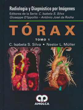 TORAX TOMO 1 Y 2 - RADIOLOGIA Y DIAGNOSTICO POR IMAGENES