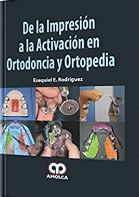 DE LA IMPRESIÓN A LA ACTIVACIÓN EN ORTODONCIA