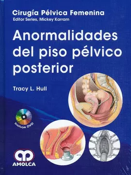 CIRUGÍA PÉLVICA FEMENINA - ANORMALIDADES DEL PISO PÉLVICO POST.