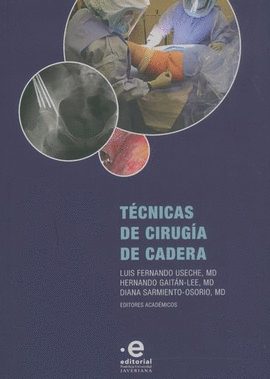 TÉCNICAS DE CIRUGÍA DE CADERA