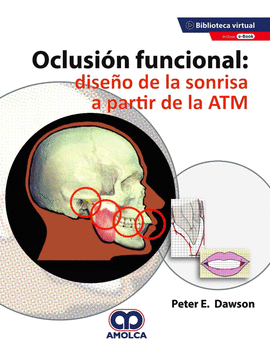 OCLUSIÓN FUNCIONAL: DISEÑO DE LA SONRISA A PARTIR DE LA ATM