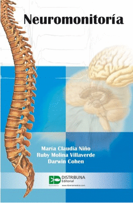 NEUROMONITORIA