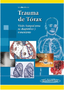 TRAUMA DE TORAX