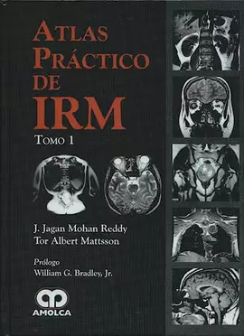 ATLAS PRACTICO DE IRM (TOMO I Y II)