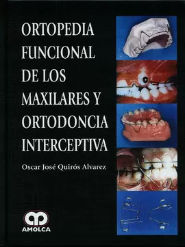 ORTOPEDIA FUNCIONAL DE LOS MAXILARES